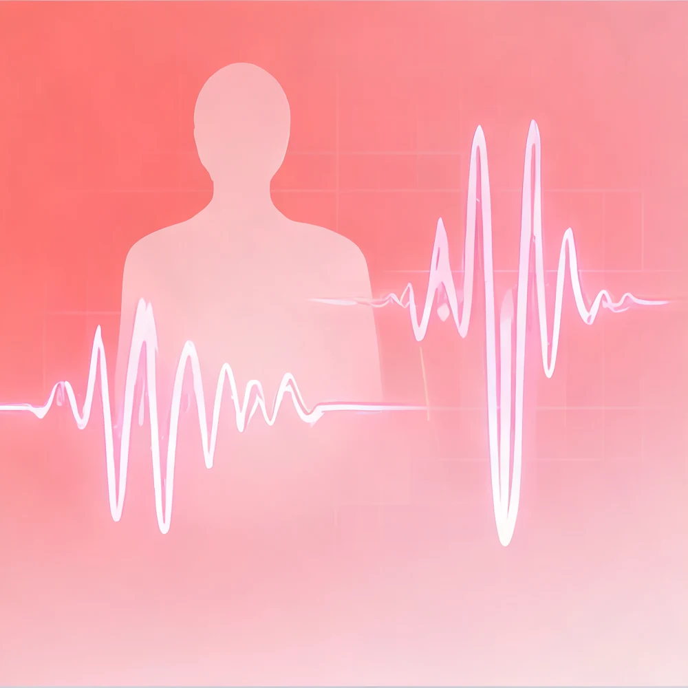 Animation